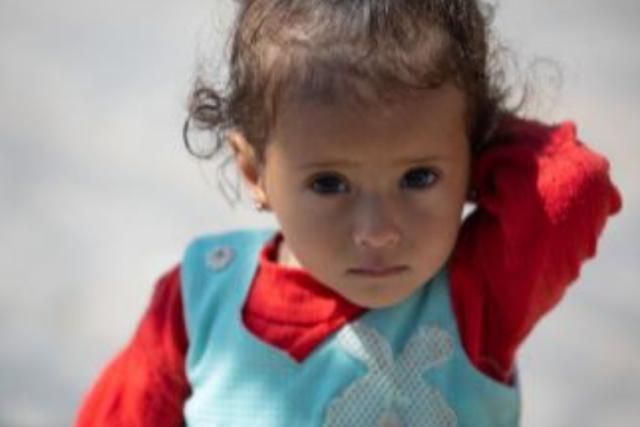 Situazione fame acuta catastrofica in Yemen: livelli mai visti