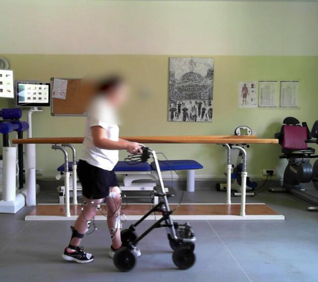 Un neurostimolatore midollare per camminare dopo una lesione spinale